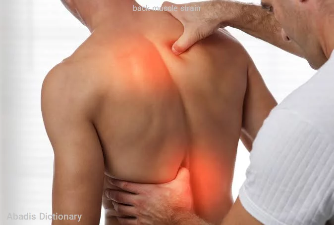 back muscle strain